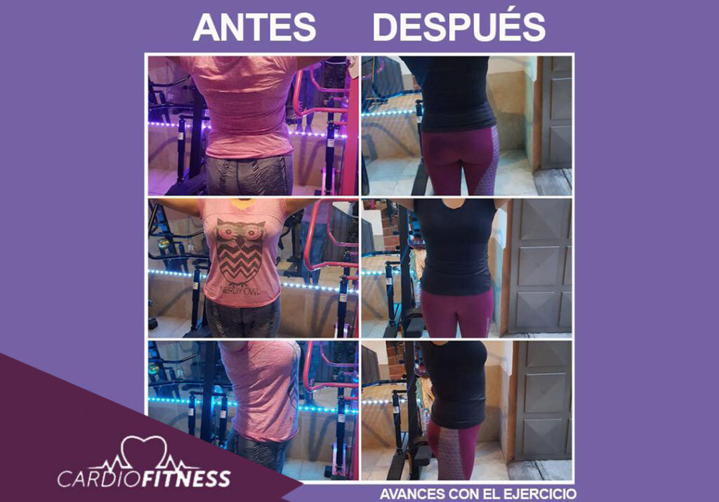 antes-despues